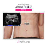 CAMPUS WAZO: Curso On-line de Ecografia Abdominal. Certificado universitário oficial emitido pela Universidade de Vitoria-Gasteiz (EUNEIZ)