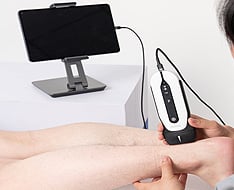 Ecógrafos Chison Sonoeye