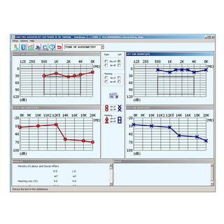 Software Sibelmed W5Ou para audiómetro Sibelmed 400