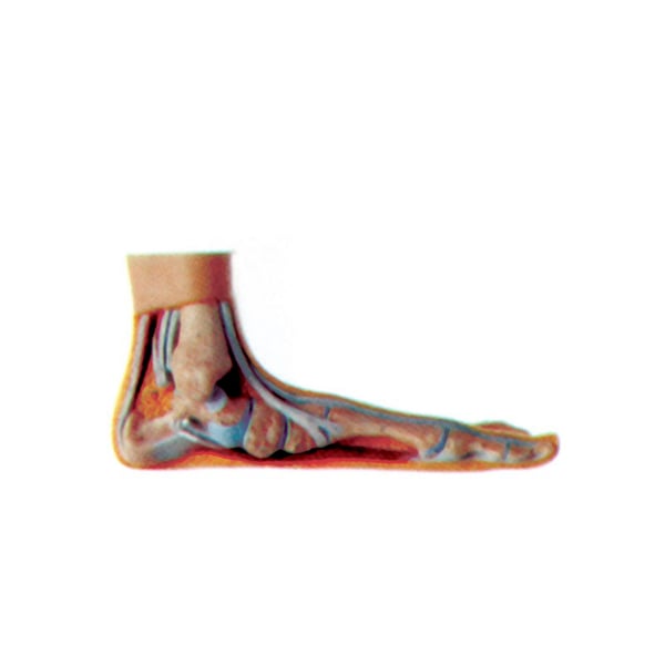 Pé exposição plano