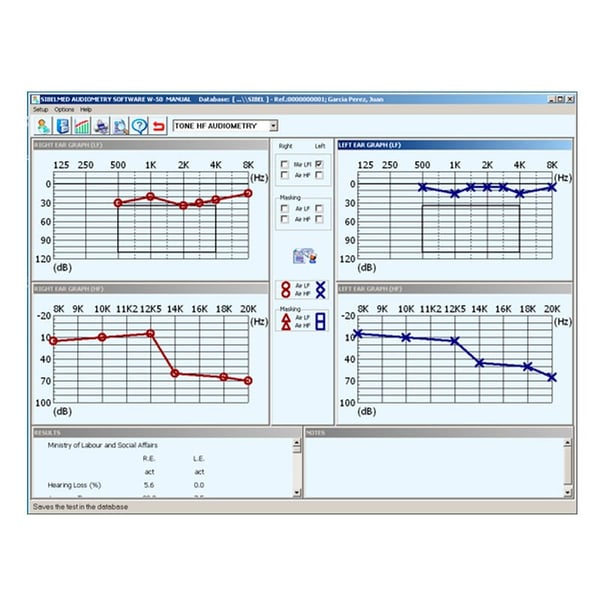 Software Sibelmed W5Ou para audiómetro Sibelmed 400