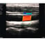 Ecógrafo portátil Sonostar: Doppler a cor, sonda linear de 10 MHz e função de assistência à punção - Produto de exposição (Última unidade)