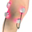 LaserPatch 650: sistema modular de laserterapia e laserpuntura