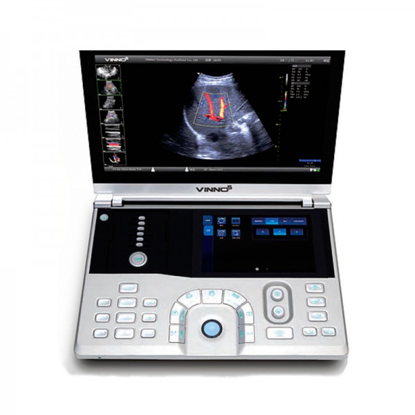 Ecógrafo Vinno 5 para Ginecologia e Obstetrícia (3D/4D) - Pack 2