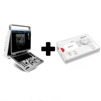 Pack poupança: Ecógrafo Chison EBit 30 com sonda linear 7.0 - 18.0 MHz + APS e4 dispositivo de electrólisis percutánea terapêutica Pack poupança: Ecógrafo Chison EBit 30 com sonda linear 7.0 - 18.0 MHz + APS e4 dispositivo de electrólisis percutánea terapêutica