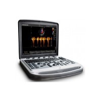 Ecógrafo portátil Chison Sonobook 8 com uma sonda a eleger - OCASIÃO Ecógrafo portátil Chison Sonobook 8 com uma sonda a eleger - OCASIÃO