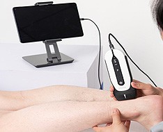 Ecógrafos Chison Sonoeye Ecógrafos Chison Sonoeye