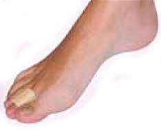 Proteções e modelos de silicona  e gel Proteções e modelos de silicona  e gel